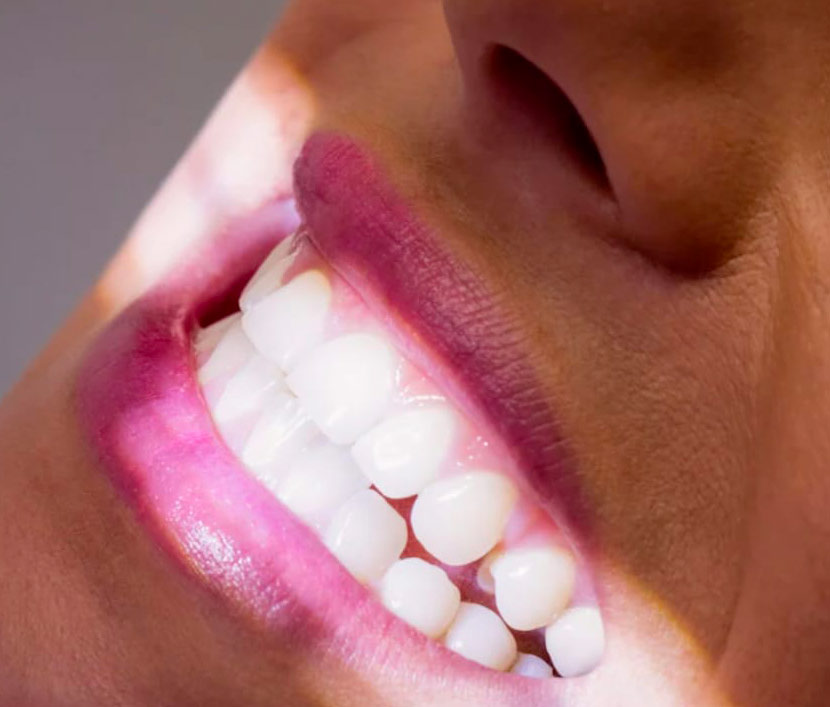 Odontoiatria conservativa